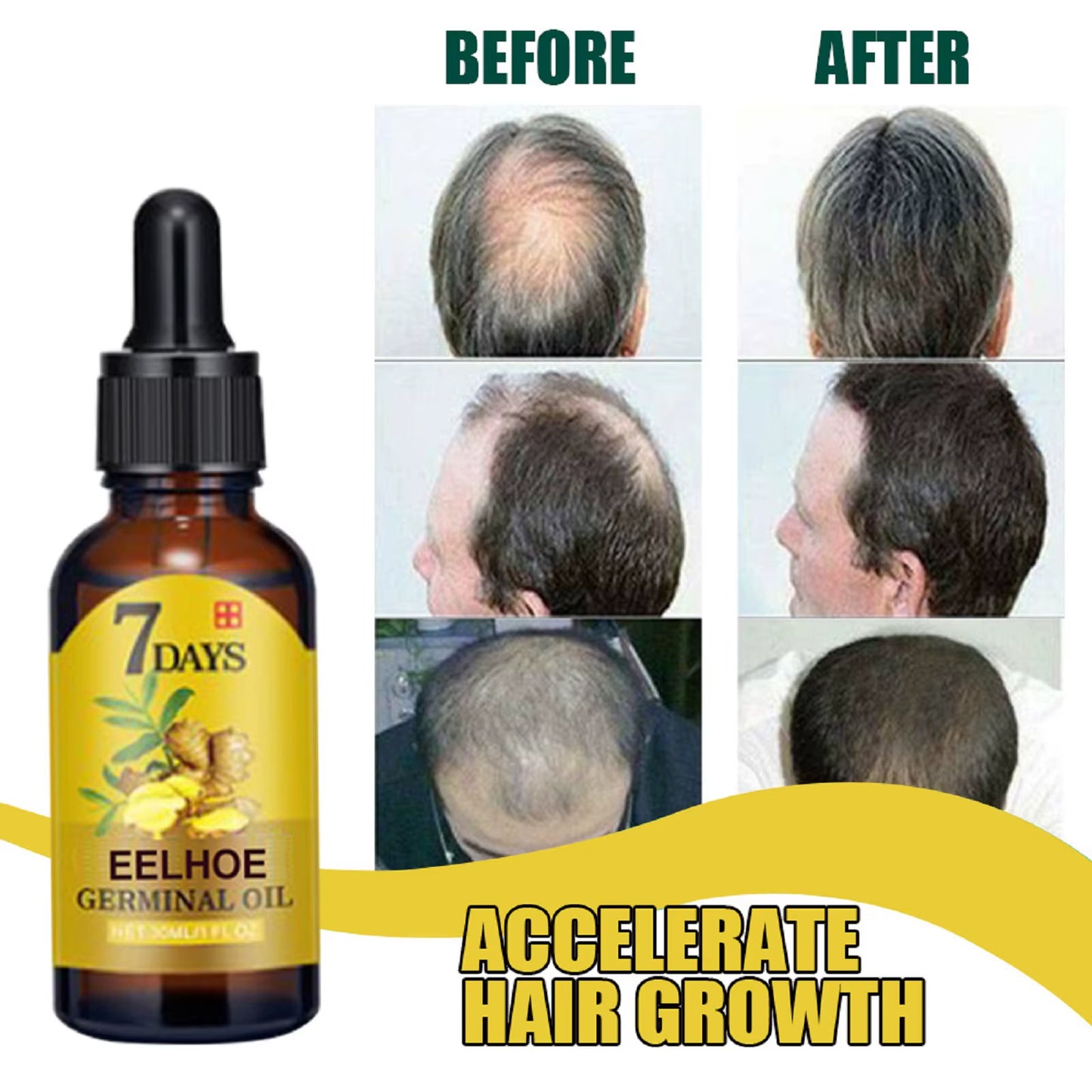 7 Day Ginger Hair Care Oil Hair Roots Scalp Treatment anti Hair Loss Scalp Treatment Serum Products Strengthen Hair Roots