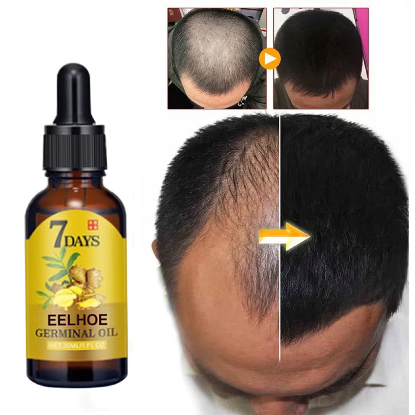 7 Day Ginger Hair Care Oil Hair Roots Scalp Treatment anti Hair Loss Scalp Treatment Serum Products Strengthen Hair Roots