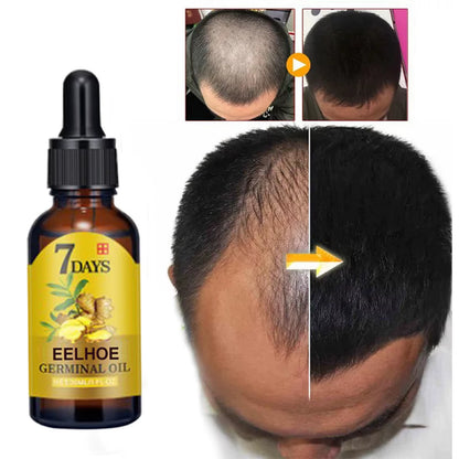 7 Day Ginger Hair Care Oil Hair Roots Scalp Treatment anti Hair Loss Scalp Treatment Serum Products Strengthen Hair Roots